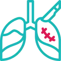 Thoracic Surgery